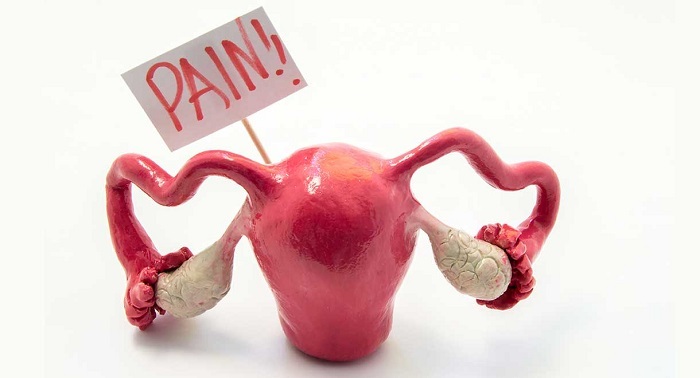 علت تنبلی تخمدان